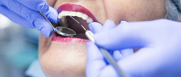 Best Emergency Root Canal Treatment in West Falmouth, MA